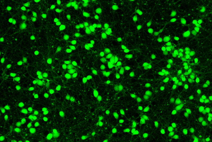 [Neuromics - 한국 공식, 모아바이오] New Human Cells Coming Soon + Your Source for iPSC-Derived Neural Cells | 연구용제품... 