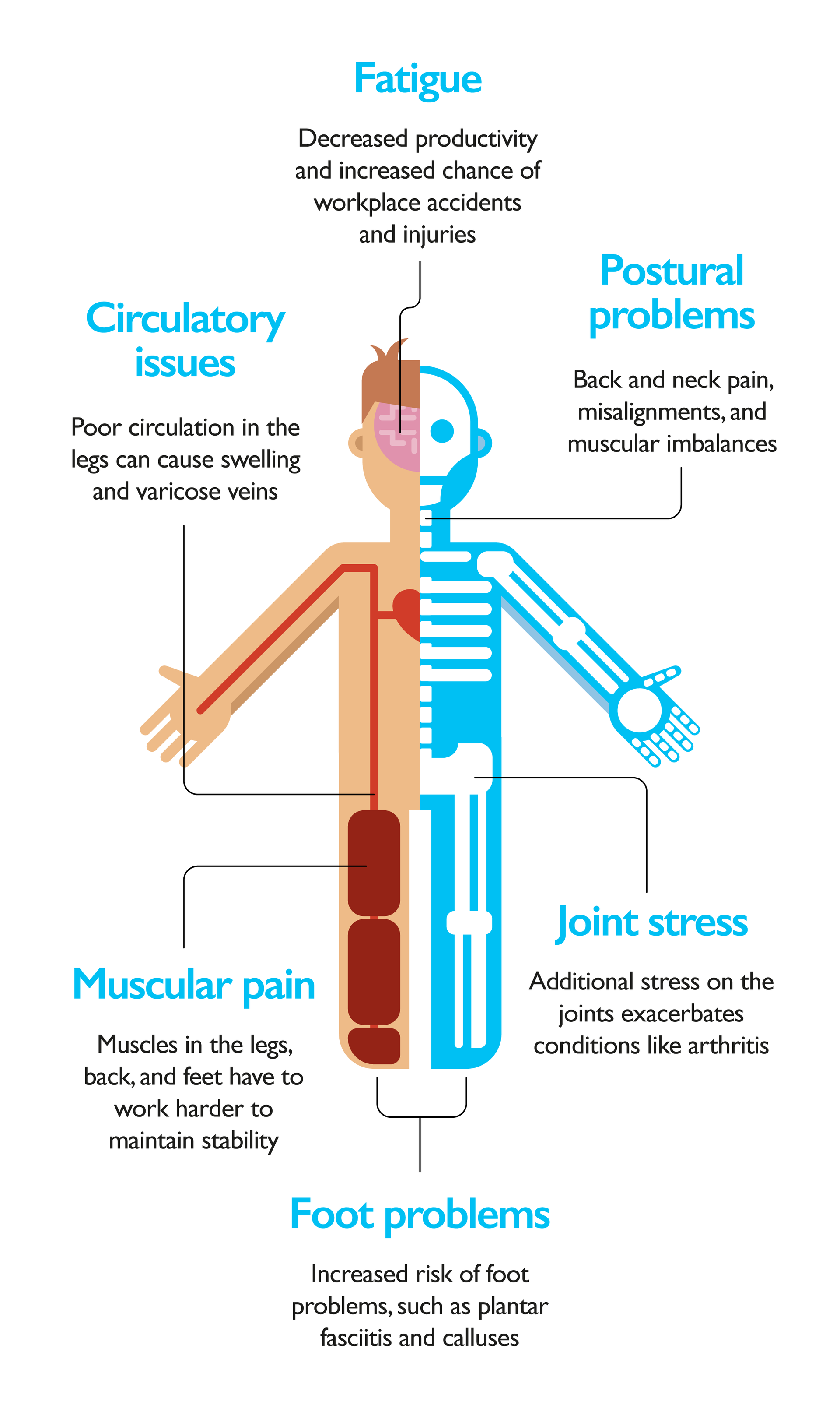 Anti-fatigue diagram