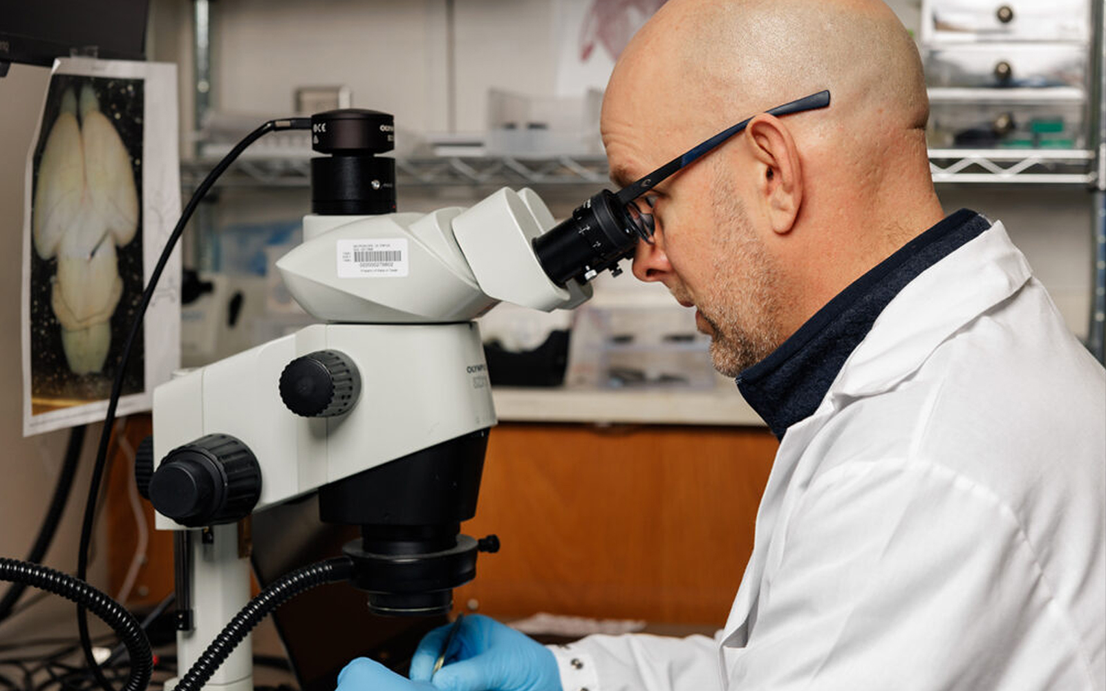 High-Dose Antioxidants Linked to Offspring Birth Defects in Animal Model