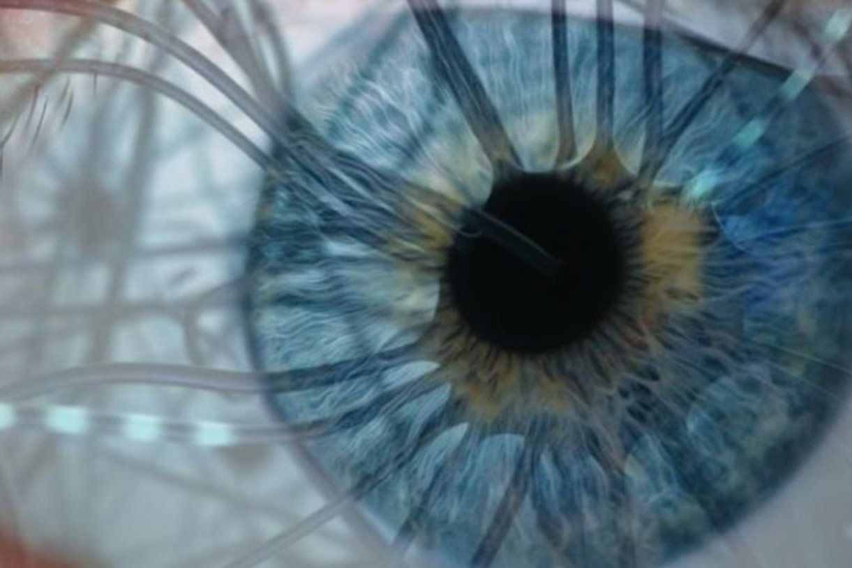 A close up of an eyeball.