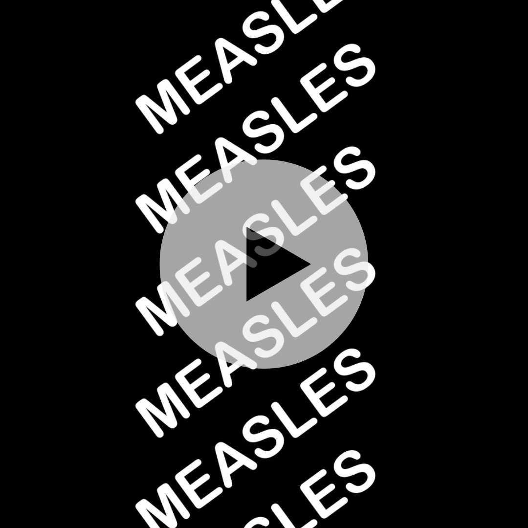 Measles, video