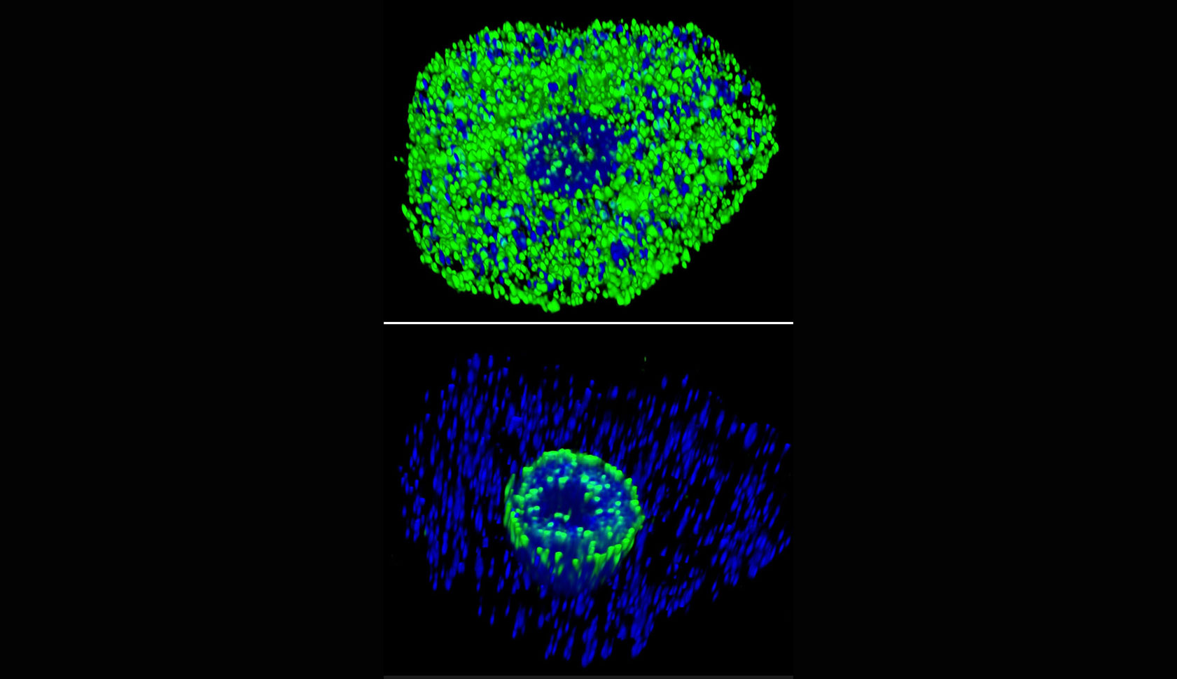 free living trophozoites