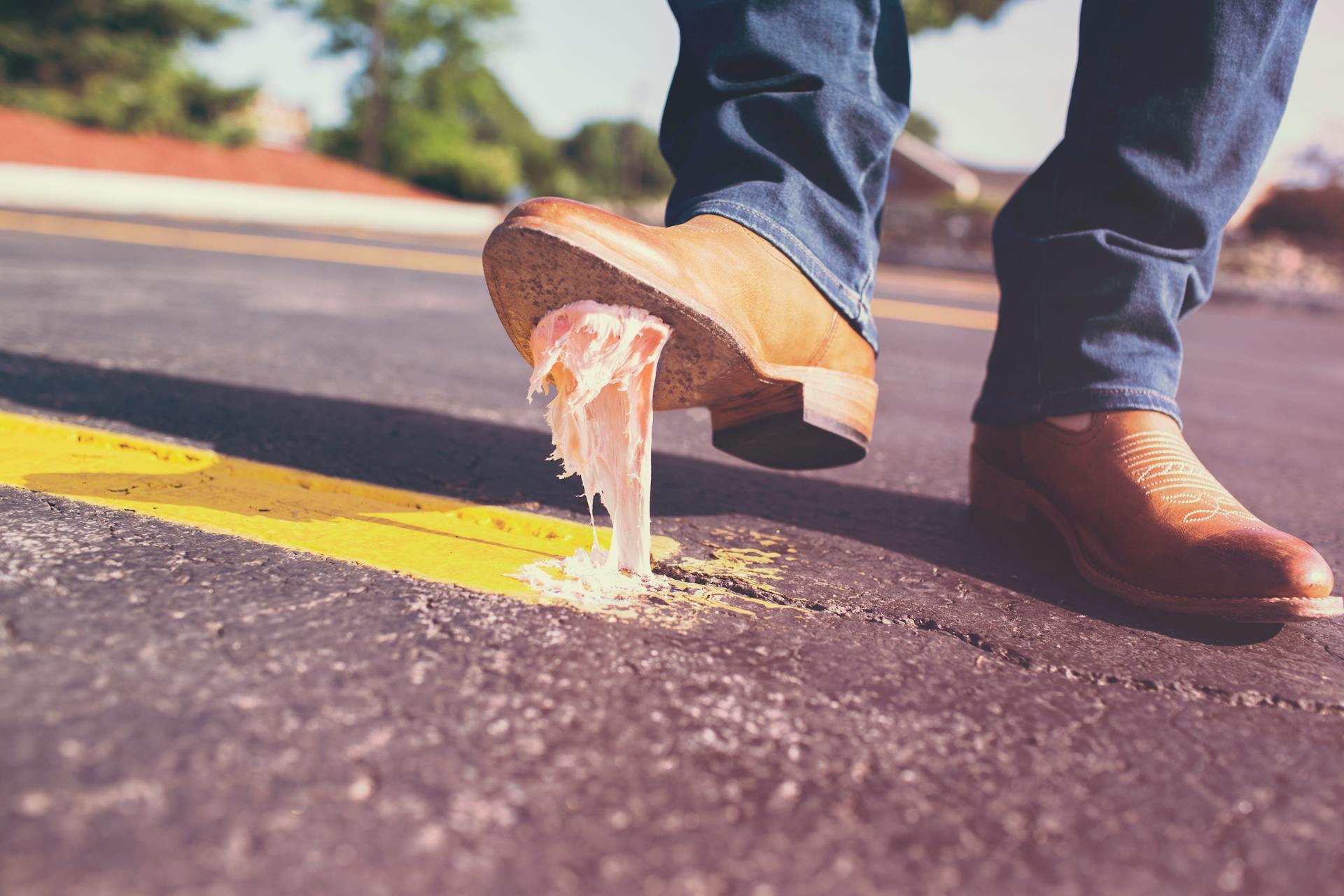 Gum removal in Ardmore , PA