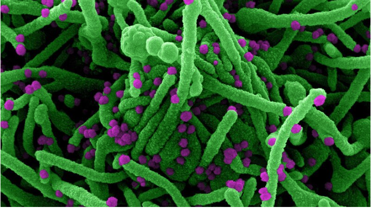 Chinese lab had COVID-19 mapped two weeks before global outbreak: documents