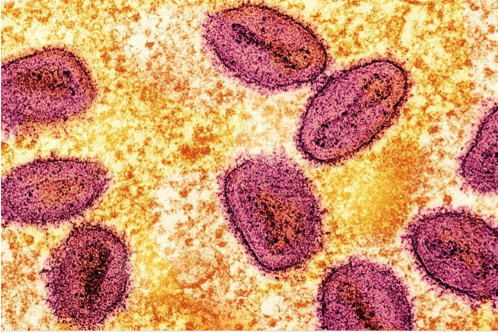 WHO Launches Global Monkeypox Strategy, Including Strategic Vaccinations