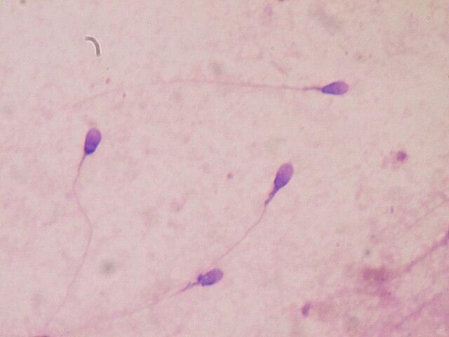 Women desperately seek unvaxed sperm on Facebook as demand skyrockets