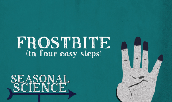Frostbite
