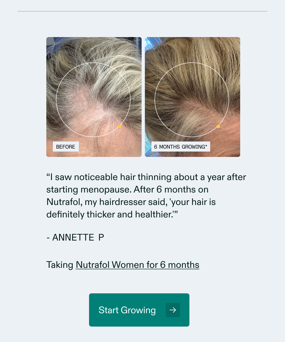 “I saw noticeable hair thinning about a year after starting menopause. After 6 months on Nutrafol, my hairdresser said, 'your hair is definitely thicker and healthier.'”- ANNETTE P | Taking Nutrafol Women’s Balance for 6 months