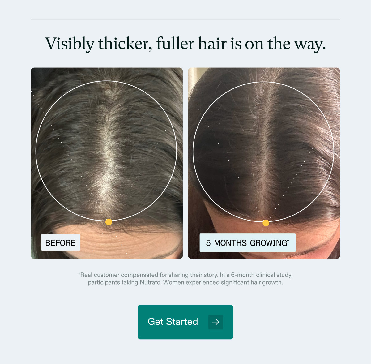 Visibly thicker, fuller hair is on the way. *Real customer compensated for sharing their story. In a 6-month clinical study, participants taking Nutrafol Women experienced significant hair growth. Get Started.