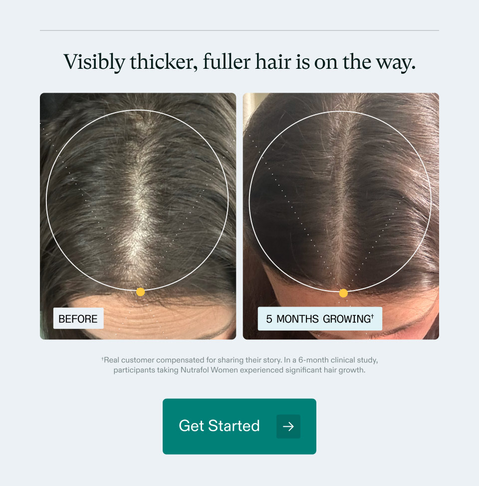 Visibly thicker, fuller hair is on the way. *Real customer compensated for sharing their story. In a 6-month clinical study, participants taking Nutrafol Women experienced significant hair growth. Get Started.