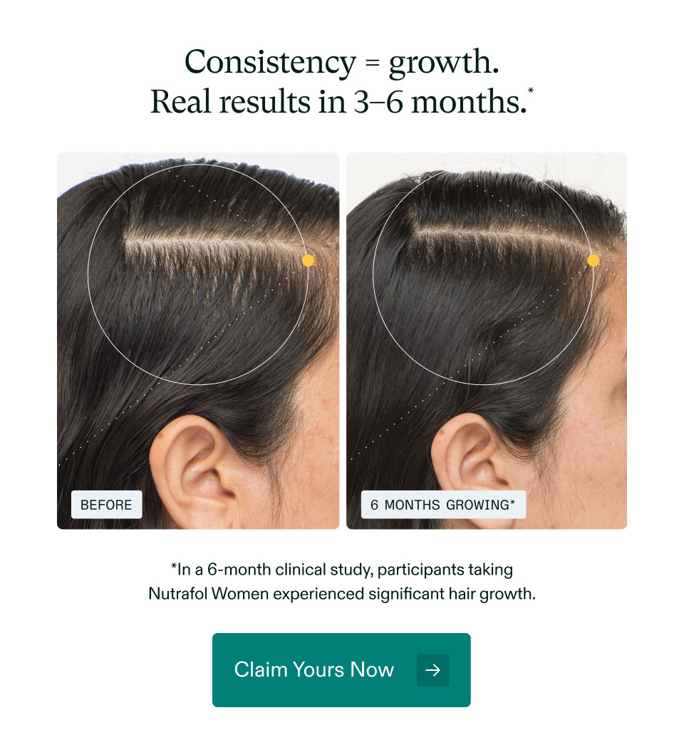 Consistency = growth. Real results in 3–6 months. In a 6-month clinical study, participants taking Nutrafol Women experienced significant hair growth. Claim Yours Now.