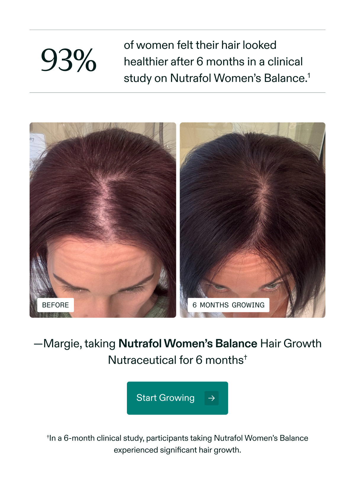 93% of women felt their hair looked healthier after 6 months in a clinical study on Nutrafol Women’s Balance. —Margie, taking Nutrafol Women’s Balance Hair Growth Nutraceutical for 6 months - Start Growing. In a 6-month clinical study, participants taking Nutrafol Women’s Balance experienced significant hair growth.