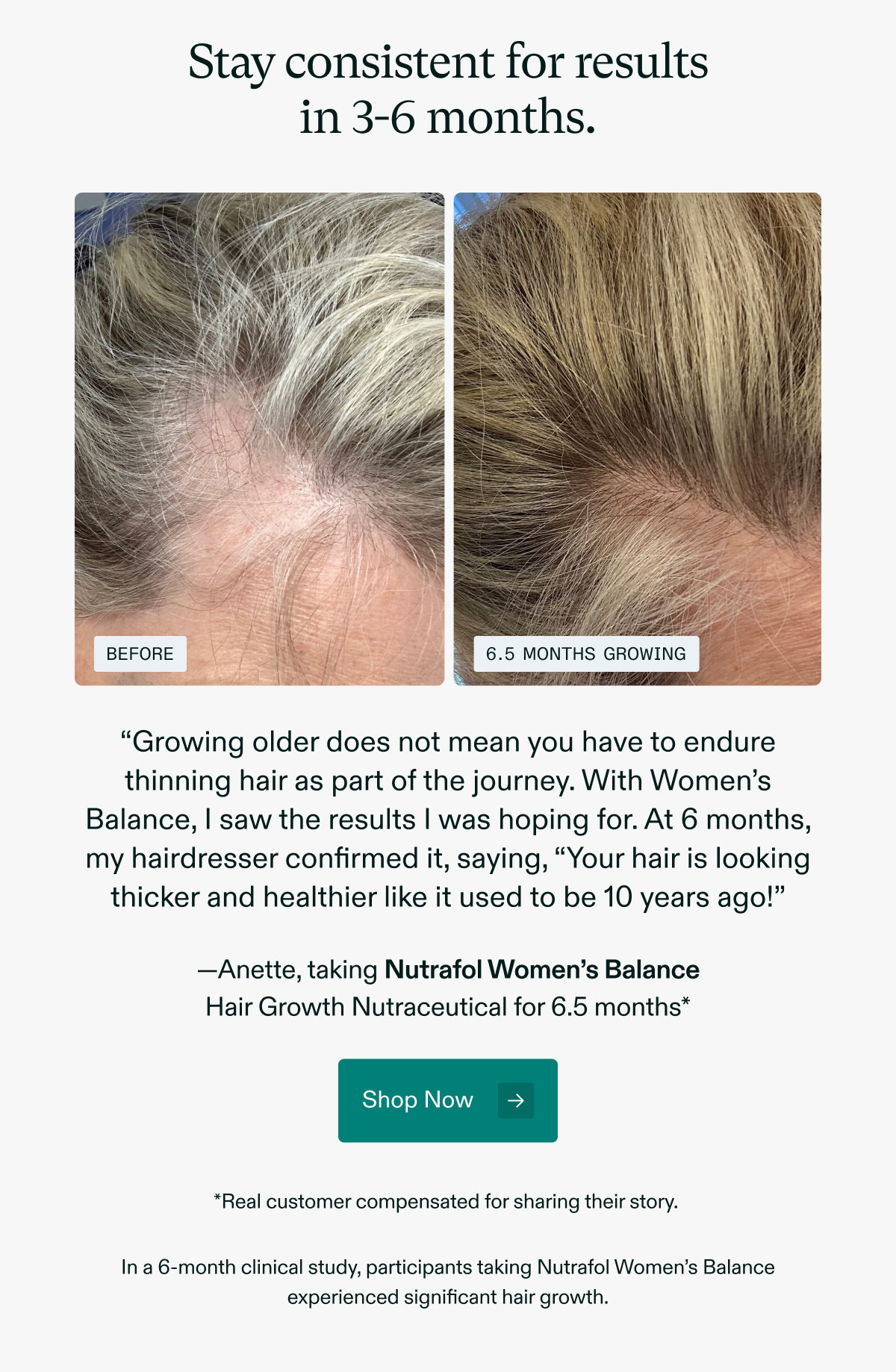 Stay consistent for results in 3-6 months. “Growing older does not mean you have to endure thinning hair as part of the journey. With Women’s Balance, I saw the results I was hoping for. At 6 months, my hairdresser confirmed it, saying, “Your hair is looking thicker and healthier like it used to be 10 years ago!” —Anette, taking Nutrafol Women’s Balance Hair Growth Nutraceutical for 6.5 months*. Shop Now. *Real customer compensated for sharing their story. In a 6-month clinical study, participants taking Nutrafol Women’s Balance experienced significant hair growth.