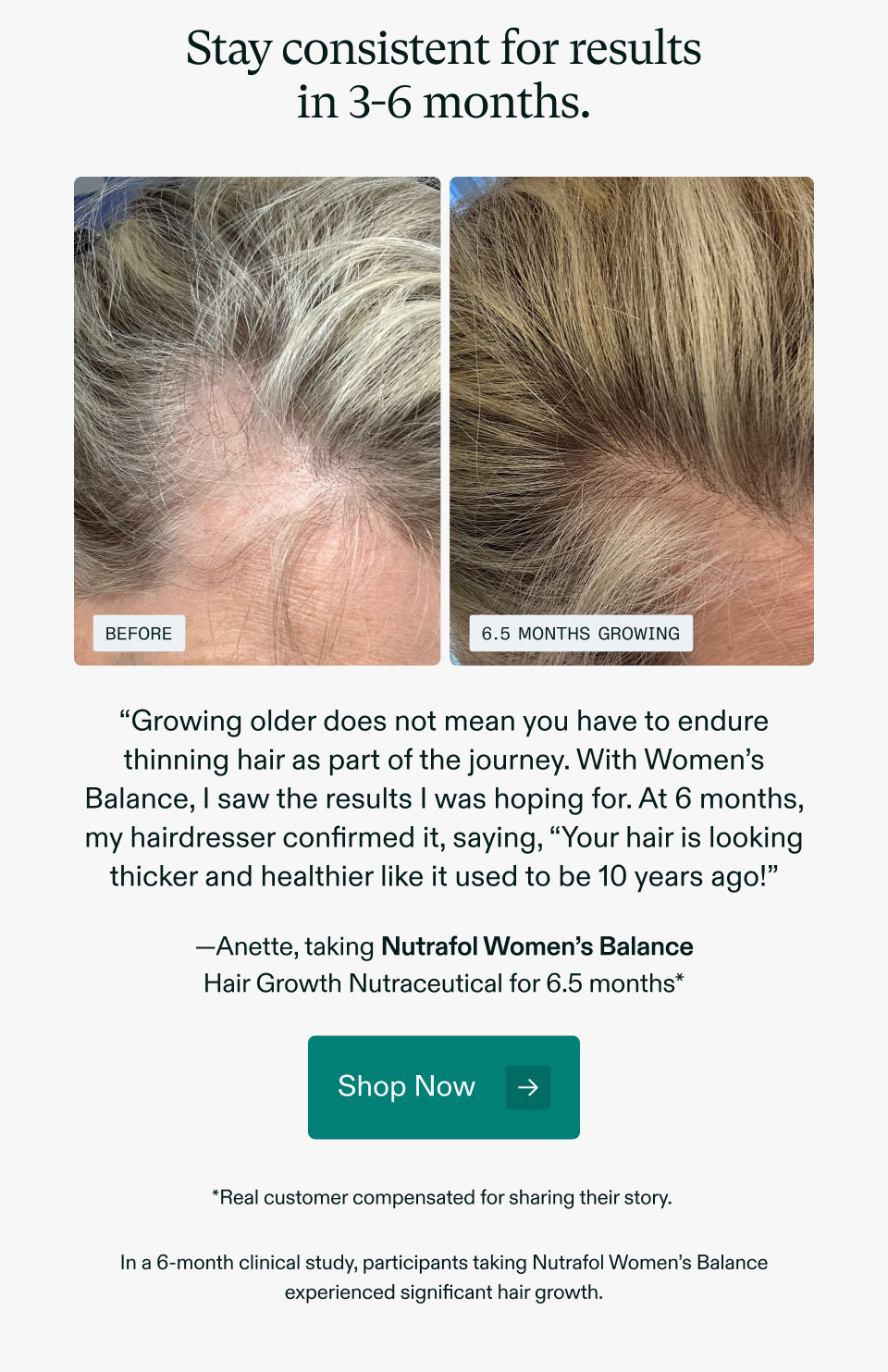 Stay consistent for results in 3-6 months. “Growing older does not mean you have to endure thinning hair as part of the journey. With Women’s Balance, I saw the results I was hoping for. At 6 months, my hairdresser confirmed it, saying, “Your hair is looking thicker and healthier like it used to be 10 years ago!” —Anette, taking Nutrafol Women’s Balance Hair Growth Nutraceutical for 6.5 months*. Shop Now. *Real customer compensated for sharing their story. In a 6-month clinical study, participants taking Nutrafol Women’s Balance experienced significant hair growth.