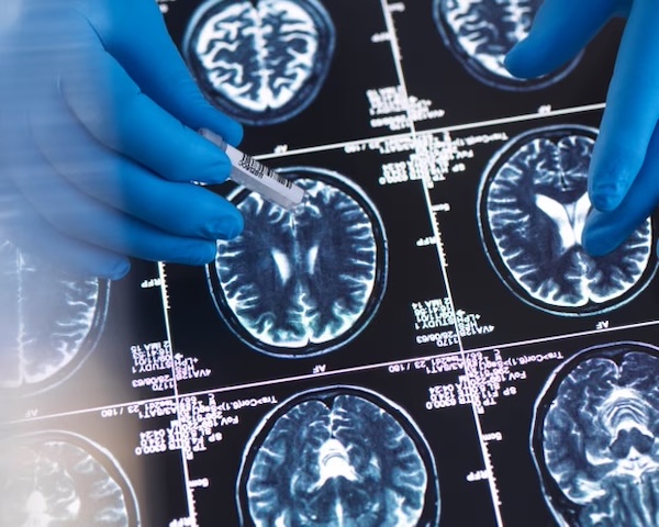 Optimists share similar brain patterns when thinking about the future, scans show | Gizmodo