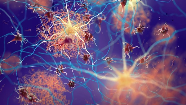 Boosting one protein helps the brain protect itself from Alzheimer's | ScienceDaily