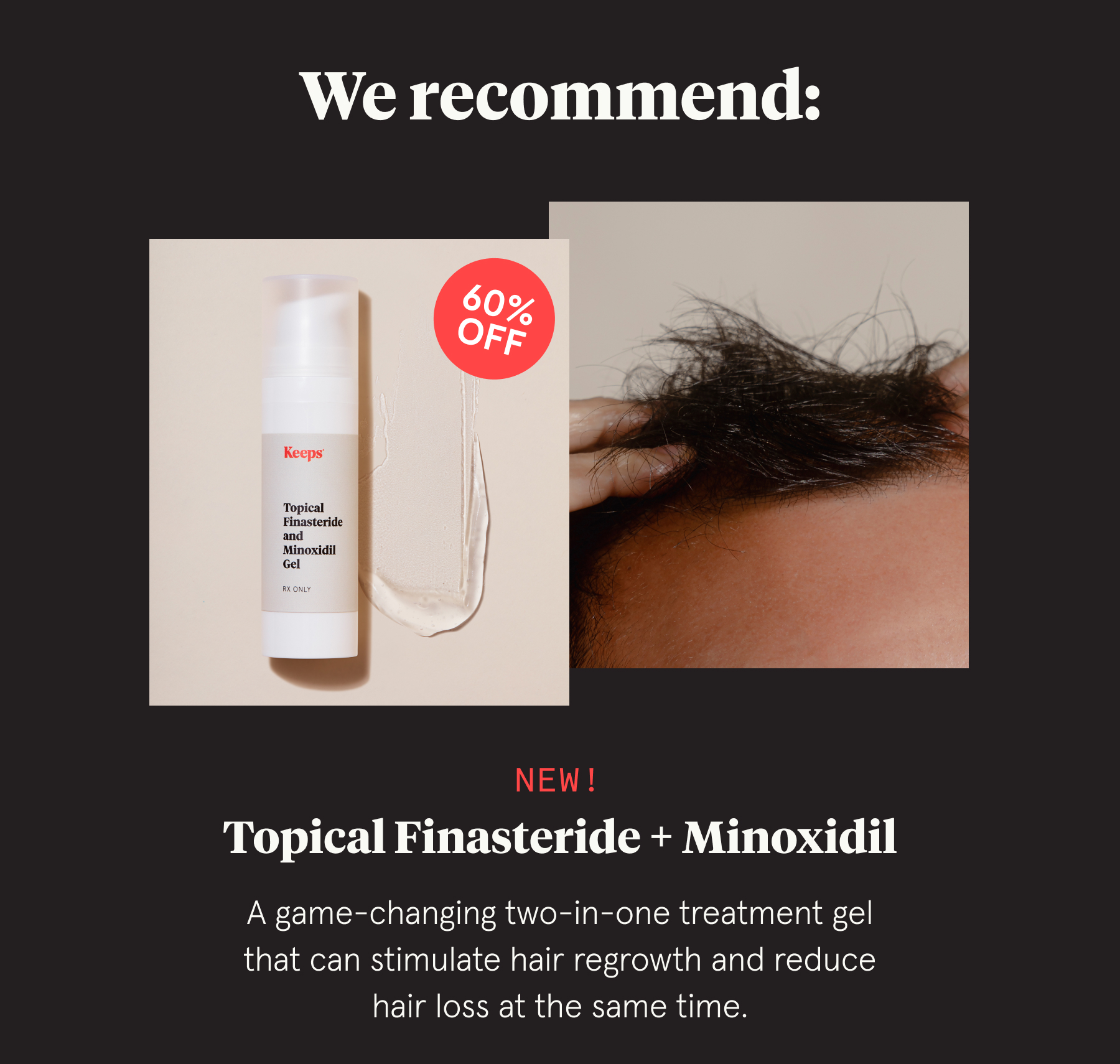 Finasteride gel buy