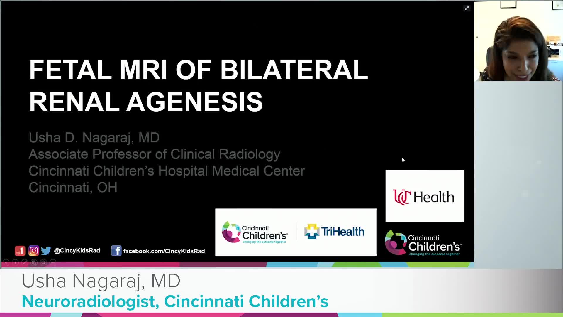 Fetal MRI of Bilateral Renal Agenesis