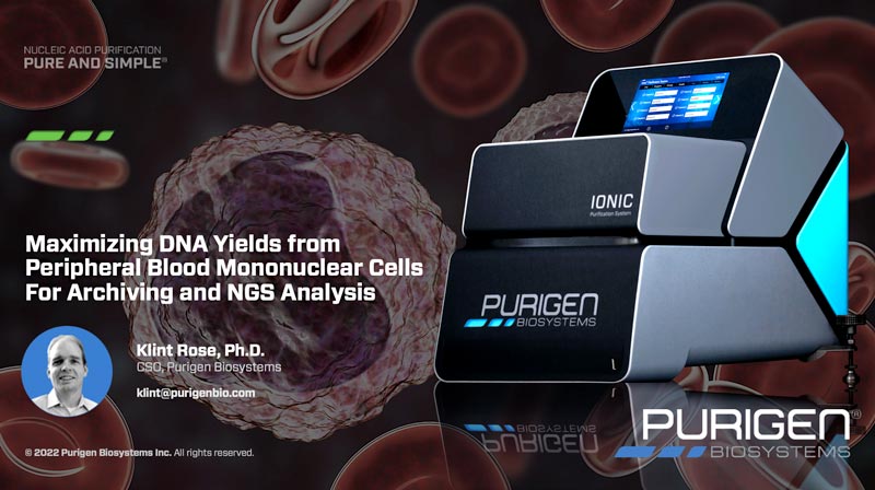 Webinar: Maximizing DNA Yields from Peripheral Blood Mononuclear Cells for Archiving and NGS Analysis