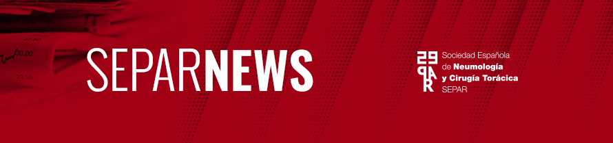 SEPARNEWS