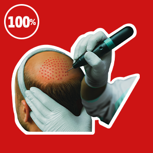 NASTŘELENÍ VLASŮ V ČESKU