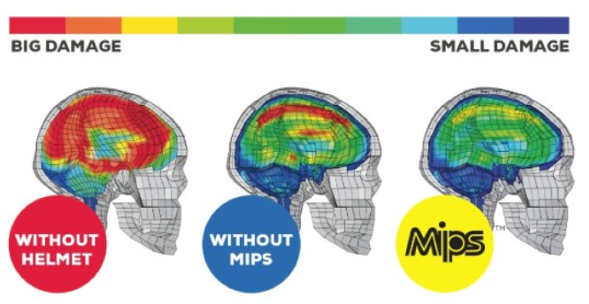 MIPS