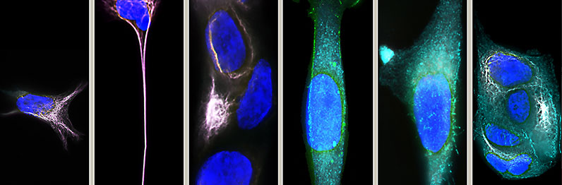 Microscopy of Cancer Cells