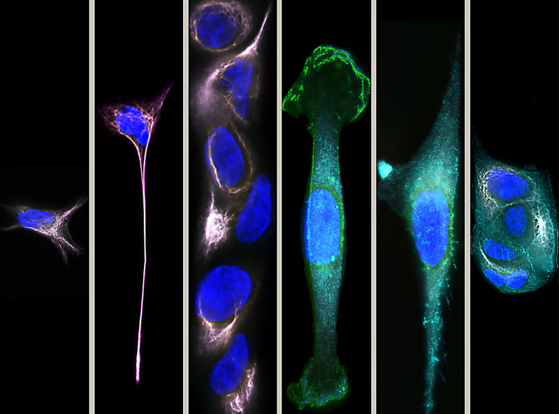 Microscopy of Cancer Cells